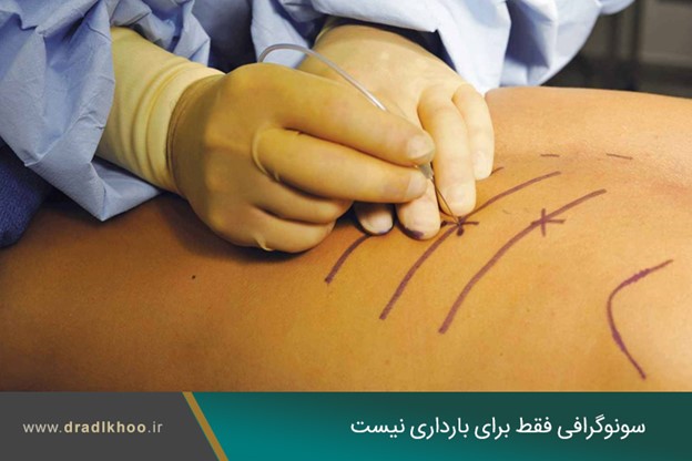 درمان درد قفسه سینه ناشی از زونا یا برش جراحی با بلاک عصبی