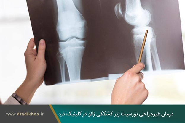 درمان غیرجراحی بورسیت زیر کشککی زانو در کلینیک درد