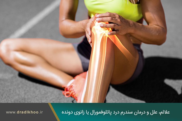 علائم، علل و درمان سندرم درد پاتلوفمورال یا زانوی دونده