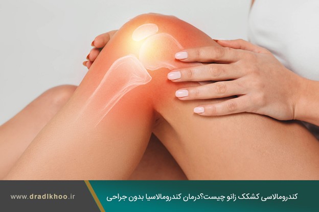 کندرومالاسی کشکک زانو چیست؟درمان کندرومالاسیا بدون جراحی