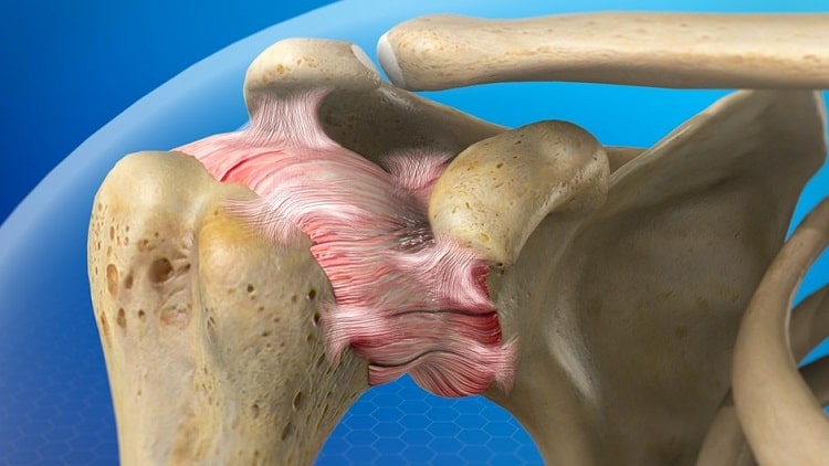 علل یخ زدگی شانه