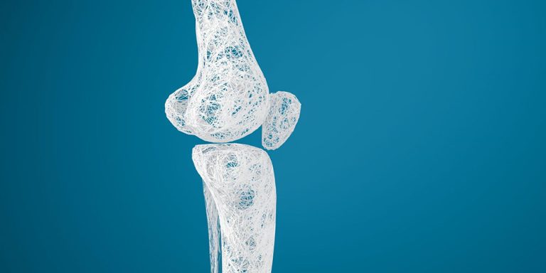 علائم پوکی استخوان
