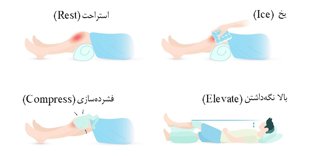 تشخیص تنیس البو 